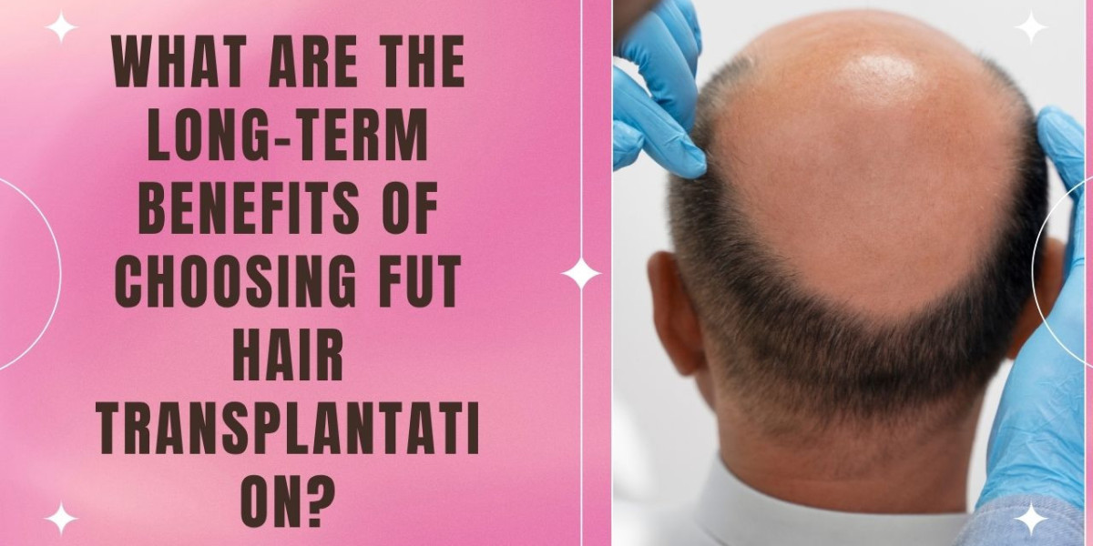 What Are the Long-Term Benefits of Choosing FUT Hair Transplantation?