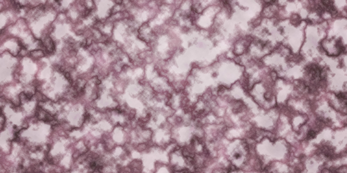 The Advantages and Considerations of An IRA Gold Account